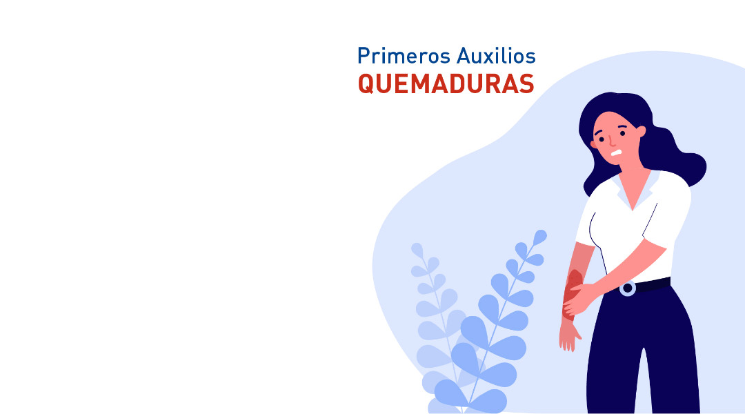 Primeros auxilios en casos de quemaduras